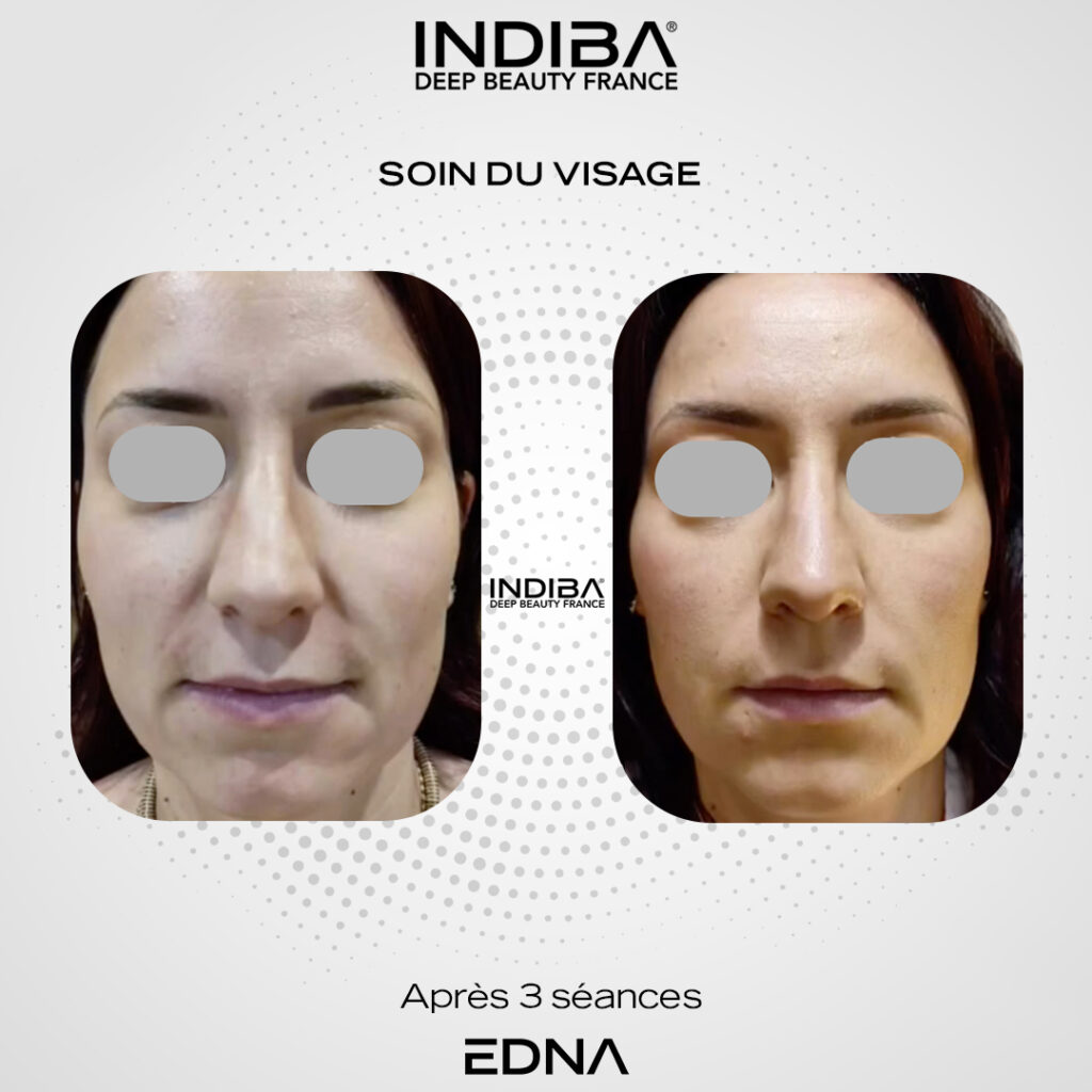 Soin-du-visage-10.jpg
