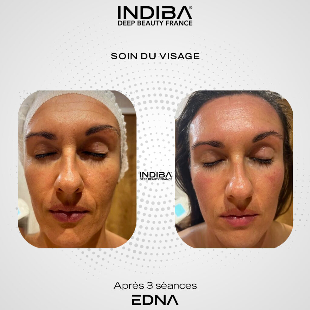 Soin-du-visage-11.jpg