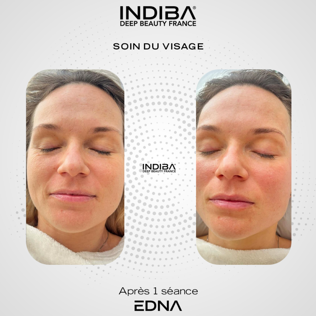 Soin-du-visage-3.png