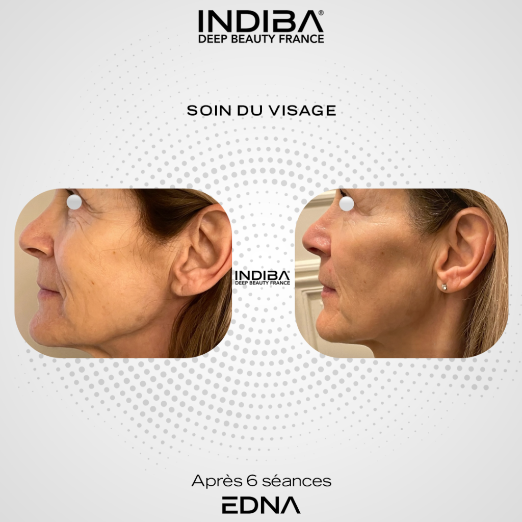 Soin-du-visage-5.png
