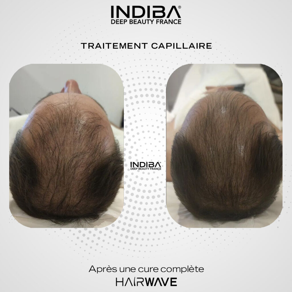 Traitement-cheveux-2.jpg