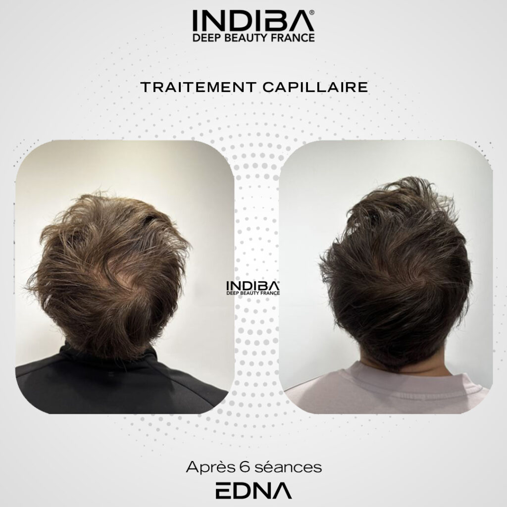 Traitement-cheveux-4.jpg